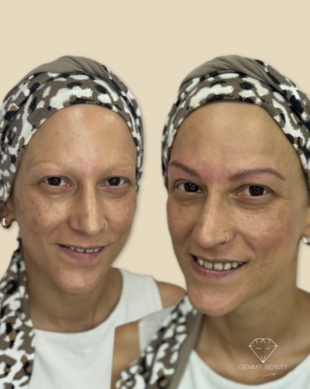 Antes y después de micropigmentación de cejas