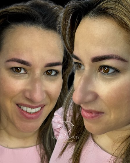 Antes y después de micropigmentación de cejas