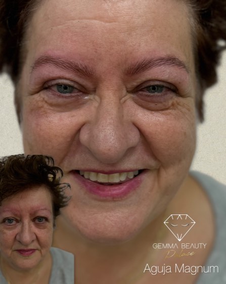 Antes y después de micropigmentación de cejas